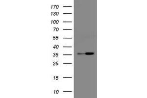 Image no. 1 for anti-Replication Factor C (Activator 1) 2, 40kDa (RFC2) antibody (ABIN1500671) (RFC2 antibody)