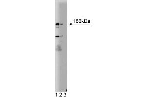 Western blot analysis of DAP Kinase on a SKN (human neuroblastoma) lysate. (DAP Kinase 1 antibody  (AA 694-947))