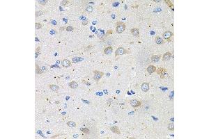 Immunohistochemistry of paraffin-embedded rat brain using GNE antibody. (GNE antibody  (AA 1-150))