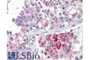 ABIN570831 (5µg/ml) staining of paraffin embedded Human Testis. (SPAG16 antibody  (Internal Region))