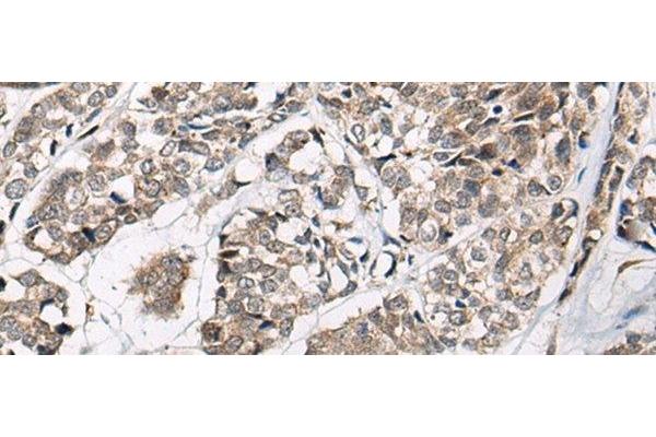 CACNB3 antibody