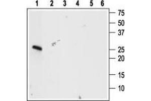 Western blot analysis using Anti-proBDNF Antibody (ABIN7043558, ABIN7044753 and ABIN7044754), (1:400):1. (Pro-Brain-Derived Neurotrophic Factor (proBDNF) Peptide)