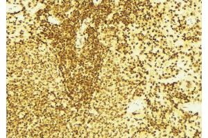 ABIN6269394 at 1/100 staining Mouse spleen tissue by IHC-P. (DOK1 antibody  (Internal Region))