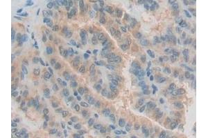 Immunohistochemistry (IHC) image for anti-Growth Differentiation Factor 10 (GDF10) (AA 337-477) antibody (ABIN7441943)