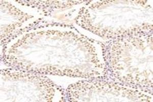 Immunohistochemistry (Paraffin-embedded Sections) (IHC (p)) image for anti-Exportin 7 (XPO7) antibody (ABIN7073901)