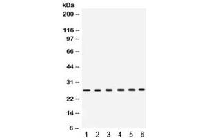 Western blot testing of 1) rat heart, 2) rat liver, 3) mouse liver, 4) human placenta, 5) COLO320 and 6) HeLa lysate with EIF3A antibody. (EIF6 antibody  (AA 66-210))