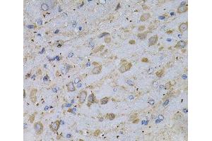 Immunohistochemistry of paraffin-embedded Rat brain using GAD2 Polyclonal Antibody at dilution of 1:100 (40x lens). (GAD65 antibody)