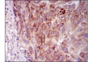 Immunohistochemistry (IHC) image for anti-Protein Kinase, CAMP-Dependent, Catalytic, gamma (PRKACG) antibody (ABIN969365)