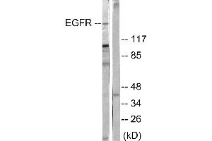 Western blot analysis of extracts from 293 cells treated with EGF (200ng/ml, 30mins), using EGFR (Ab-678) antibody (#B0008, Line 1 and 2). (EGFR antibody  (Thr678))