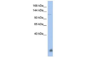 HERC5 antibody used at 1 ug/ml to detect target protein. (HERC5 antibody  (N-Term))