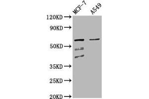 Western Blot Positive WB detected in: MCF-7 whole cell lysate, A549 whole cell lysate All lanes: SLC22A5 antibody at 4.