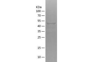 Western Blotting (WB) image for Centrosomal Protein 350kDa (CEP350) (AA 1-200) protein (His-IF2DI Tag) (ABIN7282235) (CEP350 Protein (AA 1-200) (His-IF2DI Tag))