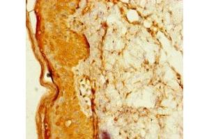 Immunohistochemistry of paraffin-embedded human skin tissue using ABIN7172741 at dilution of 1:100 (TADA2B antibody  (AA 29-328))
