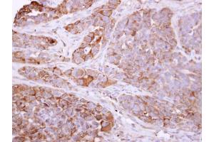 IHC-P Image Talin 1 antibody [C3], C-term detects TLN1 protein at cytosol on H357 xenograft by immunohistochemical analysis. (TLN1 antibody  (C-Term))