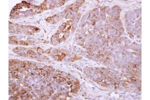 IHC-P Image Talin 1 antibody [C3], C-term detects TLN1 protein at cytosol on H357 xenograft by immunohistochemical analysis.