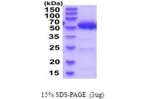 SDS-PAGE (SDS) image for Aldehyde Dehydrogenase 2 Family (Mitochondrial) (ALDH2) (AA 20-519) protein (His tag) (ABIN5854256)