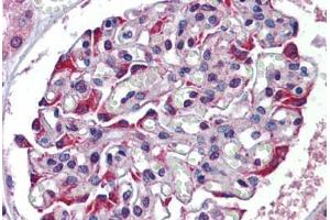 Human Kidney: Formalin-Fixed, Paraffin-Embedded (FFPE) (TDO2 antibody  (N-Term))