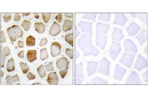 Immunohistochemistry analysis of paraffin-embedded human skeletal muscle tissue, using ATG4B Antibody. (ATG4B antibody  (AA 71-120))