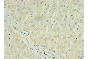 Immunohistochemistry of paraffin-embedded human liver tissue using ABIN7175057 at dilution of 1:100 (C1ORF123 antibody  (AA 1-160))