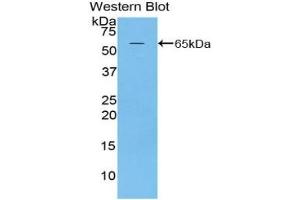 Detection of Recombinant MAP2, Rat using Polyclonal Antibody to Microtubule Associated Protein 2 (MAP2) (MAP2 antibody  (AA 1459-1718))