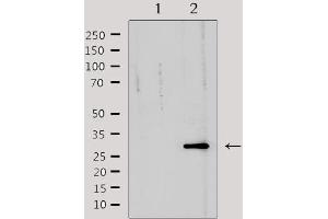 Western blot analysis of extracts from mouse heart, using TNFRSF6B Antibody. (TNFRSF6B antibody)