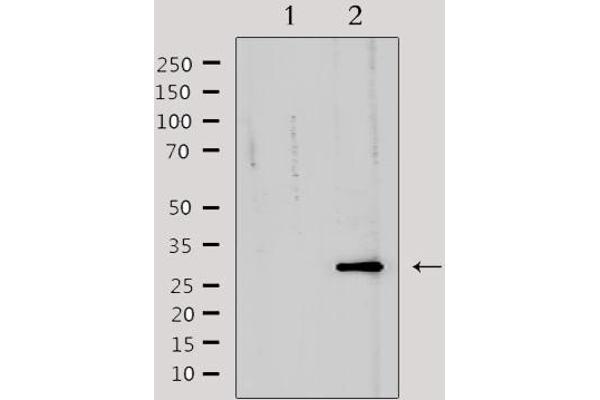 TNFRSF6B antibody
