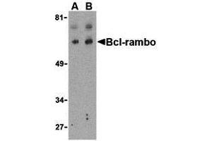 Western Blotting (WB) image for anti-BCL2-Like 13 (Apoptosis Facilitator) (BCL2L13) (Middle Region) antibody (ABIN1030885) (BCL2L13 antibody  (Middle Region))