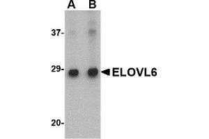 Western Blotting (WB) image for anti-ELOVL Fatty Acid Elongase 6 (ELOVL6) (N-Term) antibody (ABIN1031365)