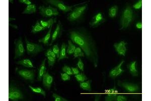 Image no. 2 for anti-serum/glucocorticoid Regulated Kinase 1 (SGK1) (AA 1-432) antibody (ABIN598922) (SGK1 antibody  (AA 1-432))