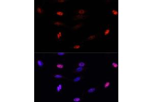 Immunofluorescence analysis of U-2 OS cells using SUMO3 antibody (ABIN7270371) at dilution of 1:100. (SUMO3 antibody  (AA 1-92))