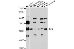 Western blot analysis of extracts of various cell lines, using BLK Antibody (ABIN5975526) at 1/1000 dilution. (BLK antibody)