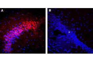 Expression of nAChRα7 in mouse hippocampusImmunohistochemical staining of perfusion-fixed frozen mouse brain sections with Guinea Pig Anti-Nicotinic Acetylcholine Receptor α7 (CHRNA7) (extracellular) Antibody (ABIN7581857), (1:300), followed by goat anti-guinea pig-Alexa-594.