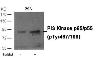 Western blot analysis of extracts from 293 cells untreated or treated with sorbitol using PI3 Kinase p85/p55 (phospho-Tyr467/199)Antibody. (PIK3R1/PIK3R3 antibody  (pTyr467))