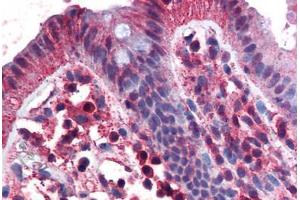 Human Colon (formalin-fixed, paraffin-embedded) stained with TNFRSF17 antibody ABIN351451 at 3 ug/ml followed by biotinylated goat anti-rabbit IgG secondary antibody ABIN481713, alkaline phosphatase-streptavidin and chromogen. (BCMA antibody  (C-Term))