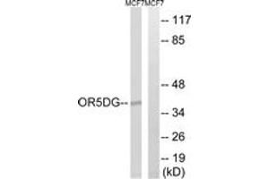 Western Blotting (WB) image for anti-Olfactory Receptor, Family 5, Subfamily D, Member 16 (OR5D16) (AA 201-250) antibody (ABIN1536062)