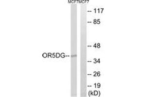 Western blot analysis of extracts from MCF-7 cells, using OR5D16 Antibody. (OR5D16 antibody  (AA 201-250))