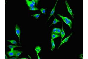 Immunofluorescent analysis of Hela cells using ABIN7157253 at dilution of 1:100 and Alexa Fluor 488-congugated AffiniPure Goat Anti-Rabbit IgG(H+L) (KBTBD6 antibody  (AA 1-139))