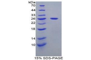 SDS-PAGE (SDS) image for SMAD, Mothers Against DPP Homolog 1 (SMAD1) (AA 271-465) protein (His tag) (ABIN1879295) (SMAD1 Protein (AA 271-465) (His tag))