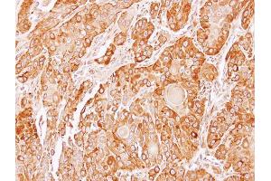 IHC-P Image Immunohistochemical analysis of paraffin-embedded SCC4 xenograft, using TXNDC4, antibody at 1:100 dilution. (ERP44 antibody)