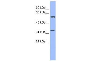 DDC antibody used at 1 ug/ml to detect target protein.