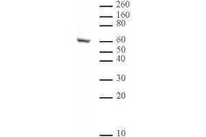 Ikaros antibody (mAb) (Clone 2A9) tested by Western blot. (IKZF1 antibody  (N-Term))