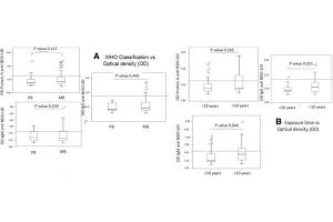 ELISA results using Rabbit Anti-Human IgM. (Rabbit anti-Human IgM Antibody)