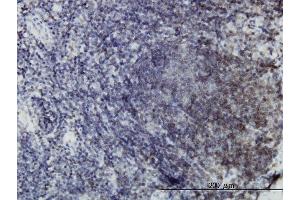 Immunoperoxidase of monoclonal antibody to EPHB3 on formalin-fixed paraffin-embedded human lymph node. (EPH Receptor B3 antibody  (AA 899-997))