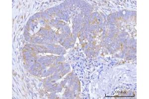 IHC analysis of Hamartin/TSC1 using anti-Hamartin/TSC1 antibody (ABIN7599499). (TSC1 antibody  (AA 1-618))