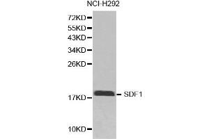 Western blot analysis of extracts of NCI-H292 cell line lysates, using CXCL12 antibody.