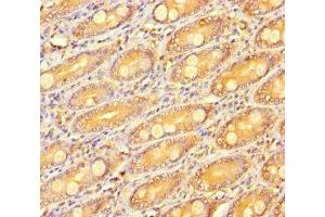 R-Spondin 3 antibody  (AA 22-272)