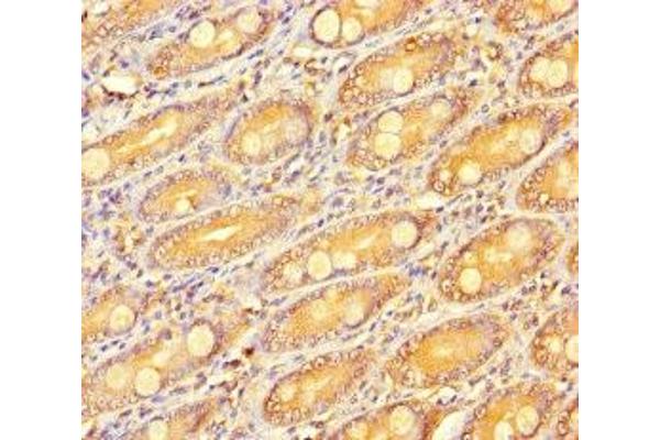 R-Spondin 3 antibody  (AA 22-272)