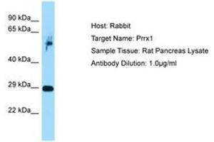 Image no. 1 for anti-Paired Related Homeobox 1 (PRRX1) (C-Term) antibody (ABIN6749858) (PRRX1 antibody  (C-Term))