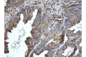 Image no. 2 for anti-Epoxide Hydrolase 1, Microsomal (Xenobiotic) (EPHX1) (AA 21-230) antibody (ABIN1491197) (EPHX1 antibody  (AA 21-230))