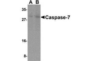 Western blot analysis of Caspase-7 in mouse skeletal muscle cell lysate with Caspase-7 antibody at (A) 0.